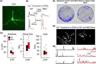 Calcium imaging: A versatile tool to examine Huntington’s disease mechanisms and progression